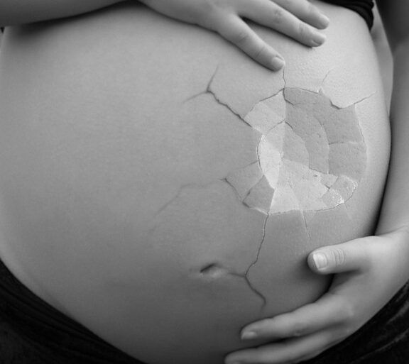 Vientre de mujer embarazada con textura agrietada y manos protegiendo, ¿Qué dice la Biblia sobre los niños abortados? Descubre la verdad aquí