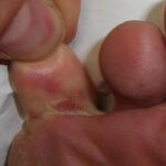 Unveiling the Truth: What the Bible Says About Incurable Diseases